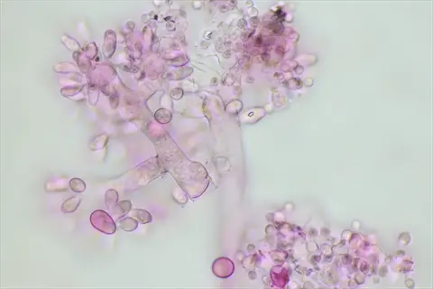 bacillus thuringiensis (bt) bacteria under microscope: gram-stained rod-shaped cells with endospores