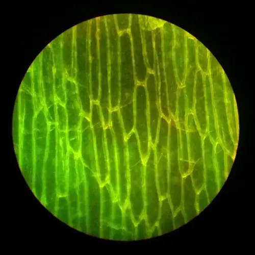 microscopy image of plant cells showing elongated structures with green and yellow pigmentation