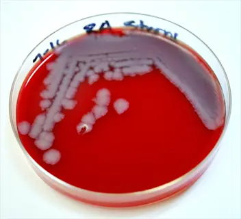 petri dish with blood agar medium showing soil bacteria colonies (likely staphylococcus) and handwritten lab notation
